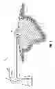 Fig. 02 - Negative pressure wound therapy dressing