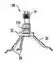 Fig. 01 - Implant insertion system