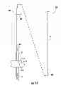 Fig. 09 - Implant insertion system
