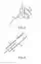 Fig. 03 - Movable magnet for magnetically guided catheter