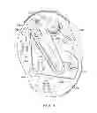 Fig. 04 - Methods for detecting failure states in a medicine delivery device