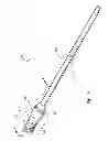 Fig. 03 - Adjustable length catheter and method of use