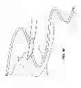 Fig. 09 - Adjustable length catheter and method of use