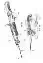 Fig. 07 - Guidewire extension system for a catheter placement device