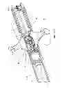 Fig. 16 - Guidewire extension system for a catheter placement device