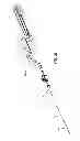 Fig. 30 - Guidewire extension system for a catheter placement device