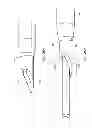 Fig. 32 - Guidewire extension system for a catheter placement device
