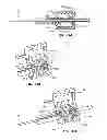 Fig. 44 - Guidewire extension system for a catheter placement device