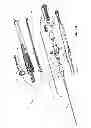Fig. 45 - Guidewire extension system for a catheter placement device
