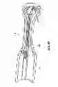 Fig. 49 - Guidewire extension system for a catheter placement device