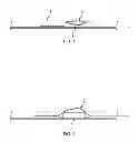 Fig. 02 - DUAL PURPOSE BALLOON CATHETERS