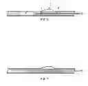 Fig. 03 - DUAL PURPOSE BALLOON CATHETERS