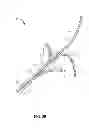 Fig. 04 - FLEXIBLE RENAL NERVE MODULATION DEVICE