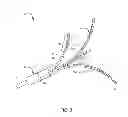 Fig. 05 - FLEXIBLE RENAL NERVE MODULATION DEVICE