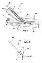 Fig. 02 - Systems for creating arteriovenous (AV) fistulas
