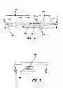 Fig. 04 - Systems for creating arteriovenous (AV) fistulas