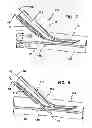 Fig. 05 - Systems for creating arteriovenous (AV) fistulas