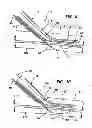 Fig. 06 - Systems for creating arteriovenous (AV) fistulas