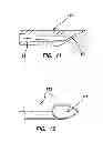 Fig. 07 - Systems for creating arteriovenous (AV) fistulas