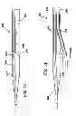 Fig. 09 - Systems for creating arteriovenous (AV) fistulas