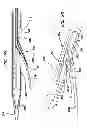 Fig. 12 - Systems for creating arteriovenous (AV) fistulas