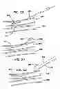Fig. 14 - Systems for creating arteriovenous (AV) fistulas
