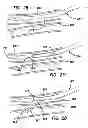Fig. 15 - Systems for creating arteriovenous (AV) fistulas