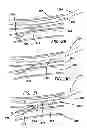 Fig. 16 - Systems for creating arteriovenous (AV) fistulas