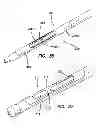 Fig. 19 - Systems for creating arteriovenous (AV) fistulas