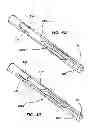Fig. 22 - Systems for creating arteriovenous (AV) fistulas