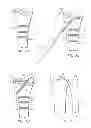 Fig. 06 - System for treating bone fractures