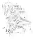 Fig. 08 - System for treating bone fractures