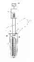 Fig. 01 - EXPANDABLE PROXIMAL REAMER