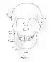 Fig. 06 - Surgical guide with cut resistant inserts