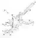 Fig. 01 - Method for surgically implanting a prosthetic patella component