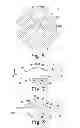 Fig. 06 - Method for surgically implanting a prosthetic patella component