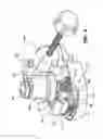 Fig. 04 - Motorized bone cement mixing and delivery system with an enlarged connector for connecting to the cannula through which the cement is injected into the patient