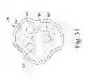 Fig. 16 - Patella drill guide and trial surgical instrument