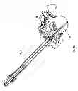 Fig. 17 - Minimally invasive spine surgery instruments: guide wire handle with a guide wire locking mechanism