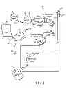 Fig. 02 - MICRO-ELECTRODE RECORDING-GUIDED IMPLANTATION OF DIRECTIONAL LEADS