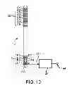 Fig. 09 - MICRO-ELECTRODE RECORDING-GUIDED IMPLANTATION OF DIRECTIONAL LEADS