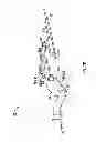 Fig. 09 - Offset remote center manipulator for robotic surgery