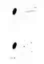 Fig. 02 - OPHTHALMIC WOUND CLOSURE DEVICES AND METHODS