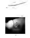 Fig. 06 - OPHTHALMIC WOUND CLOSURE DEVICES AND METHODS