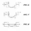 Fig. 06 - Suture guide and ruptured tissue repair