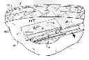 Fig. 01 - Surgical implant and applicator