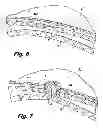 Fig. 04 - Surgical implant and applicator