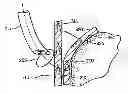 Fig. 01 - Methods and devices for manipulating tissue