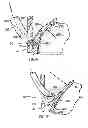 Fig. 05 - Methods and devices for manipulating tissue