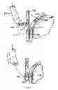 Fig. 06 - Methods and devices for manipulating tissue